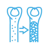 Osteoporosis Treatment